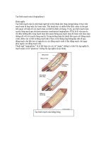 Tạo hình mạch máu