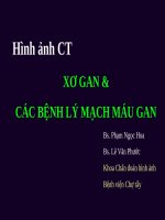 XOGAN- BLMACHMAU.PPT