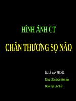 Chanthuongsonao