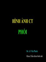 CT-phoi2001 y học