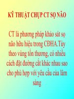 KT_CHUP_CT_SONAO