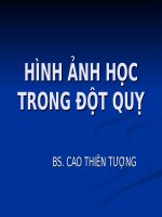 ĐỘT QUỴ