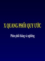 X QUANG PHỔI QUY ước (LAO) (chữ biến dạng do slide dùng font VNI times, tải về xem bình thường) 