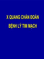 X QUANG CHẨN đoán BỆNH lý TIM MẠCH (NHI KHOA) 