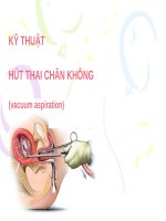 KỸ THUẬT hút THAI CHÂN KHÔNG (THỰC HÀNH sản PHỤ KHOA) 