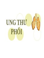 UNG THƯ PHỔI (nội) 