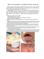 Benh tay chan mieng cach phong tri benh