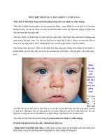 Tải Phân biệt tay chân miệng và thủy đậu - Dấu hiệu nhận biết bệnh tay chân miệng và thủy đậu