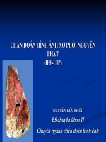 Chẩn đoán hình ảnh xơ phổi nguyên phát