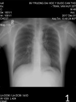 xquang ngực - Sinh học - Trần Thị Hường - Thư viện Bài giảng điện tử