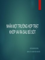 NHÂN MỘT TRƯỜNG HỢP TRẬT KHỚP VAI RA SAU BỎ SÓT.BS.TRẦN BÌNH DƯƠNG.KHOA CTCH - BỆNH VIỆN CHỢ RẪY