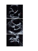 Andersons pediatric cardiology 1395 