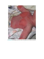 Pediatric emergency medicine trisk 1328 1328 