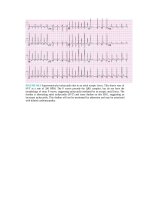 Pediatric emergency medicine trisk 1728 1728 