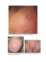 Pediatric emergency medicine trisk 1335 1335 