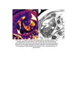 Andersons pediatric cardiology 204 