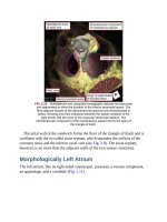 Andersons pediatric cardiology 72 