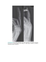 Pediatric emergency medicine trisk 3349 3349 