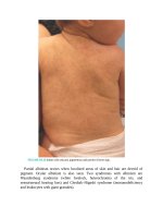 Pediatric emergency medicine trisk 1346 1346 