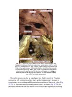 Andersons pediatric cardiology 980 