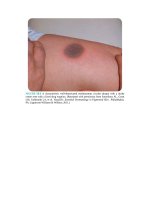 Pediatric emergency medicine trisk 1313 1313 