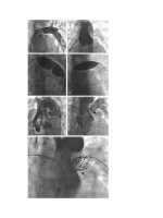 Andersons pediatric cardiology 1352 