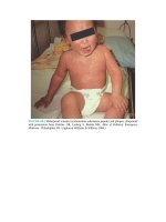 Pediatric emergency medicine trisk 1307 1307 