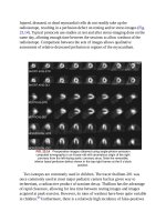 Andersons pediatric cardiology 605 