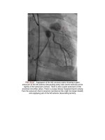 Andersons pediatric cardiology 1398 