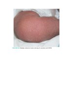 Pediatric emergency medicine trisk 1327 1327 