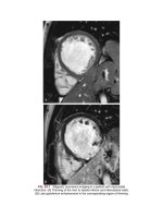 Andersons pediatric cardiology 1397 