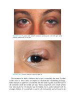 Pediatric emergency medicine trisk 4057 4057 