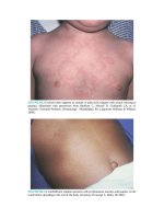 Pediatric emergency medicine trisk 1308 1308 