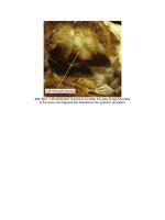 Andersons pediatric cardiology 1369 