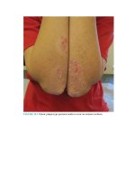 Pediatric emergency medicine trisk 1357 1357 