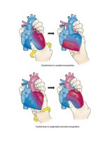 Andersons pediatric cardiology 1312 