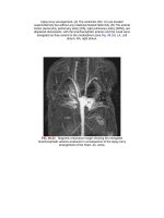 Andersons pediatric cardiology 1315 