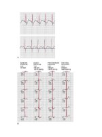 Andersons pediatric cardiology 604 