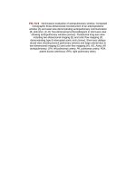 Andersons pediatric cardiology 1351 