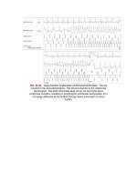 Andersons pediatric cardiology 562 