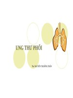 Bài giảng  UNG THƯ PHỔI