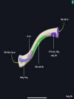 Xương chi trên GP1