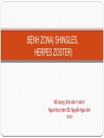 Bệnh zona thần kinh bệnh giờ leo