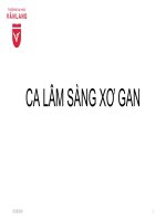 Phân tích Ca lâm sàng Xơ gan
