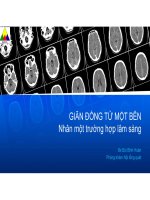 Giãn Đồng tử một bên