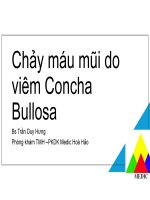 Chảy máu mũi do viêm concha bullosa