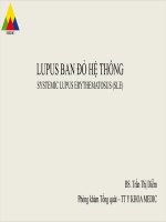 Lupus ban Đỏ hệ thống