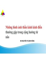 Những hình Ảnh thần kinh kinh Điển thường gặp trong cộng hưởng từ não