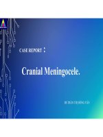 Cranial meningocele case report