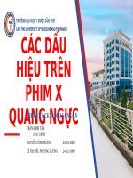 Các dấu hiệu trên phim  x-quang ngực (1)
